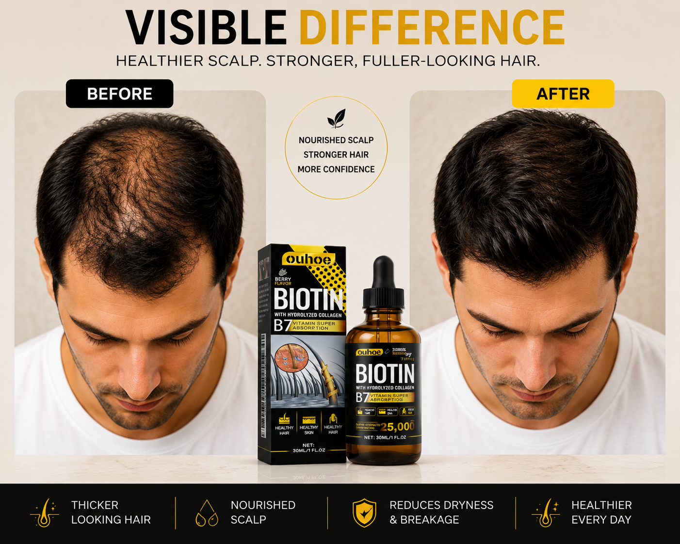 Biotin & Collagen Hair Oil – Rosemary & Ginseng Scalp Serum (30ml)