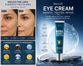Eye Tightening Gel with Caffeine, Retinol & Hyaluronic Acid – Hydrating Anti-Aging Eye Cream | 20g