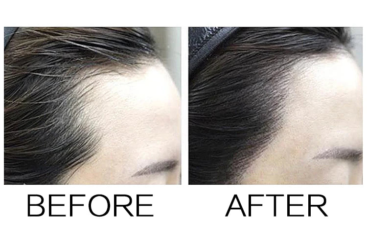 Sevich Hairline Powder – Instant Root & Hairline Concealer for Men & Women | 4g