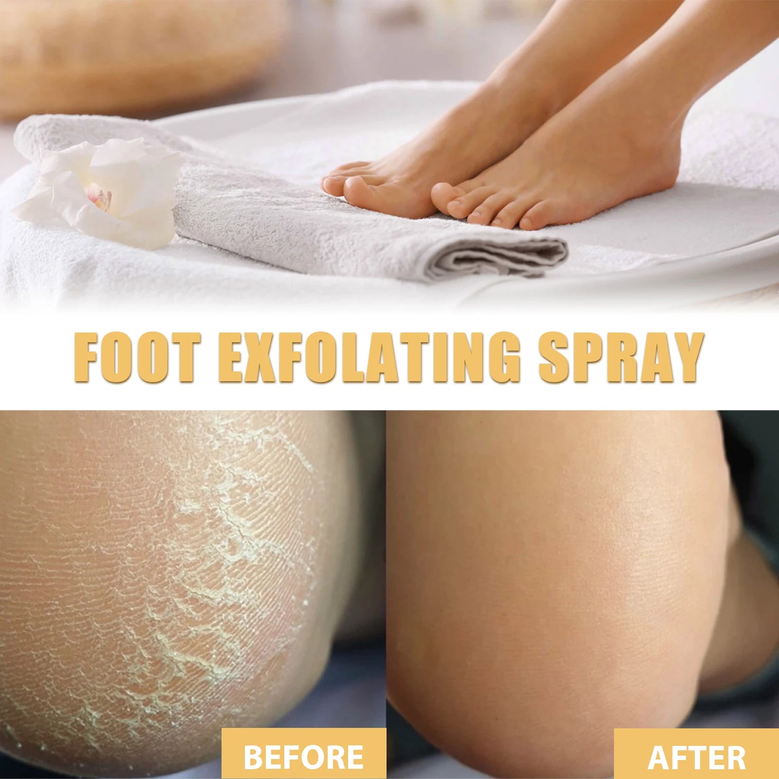 OUHOE Foot Exfoliating Spray 200ml – Callus Softener, Dry Cracked Heel Repair, 72H Moisture Lock & Odor Control Foot Care