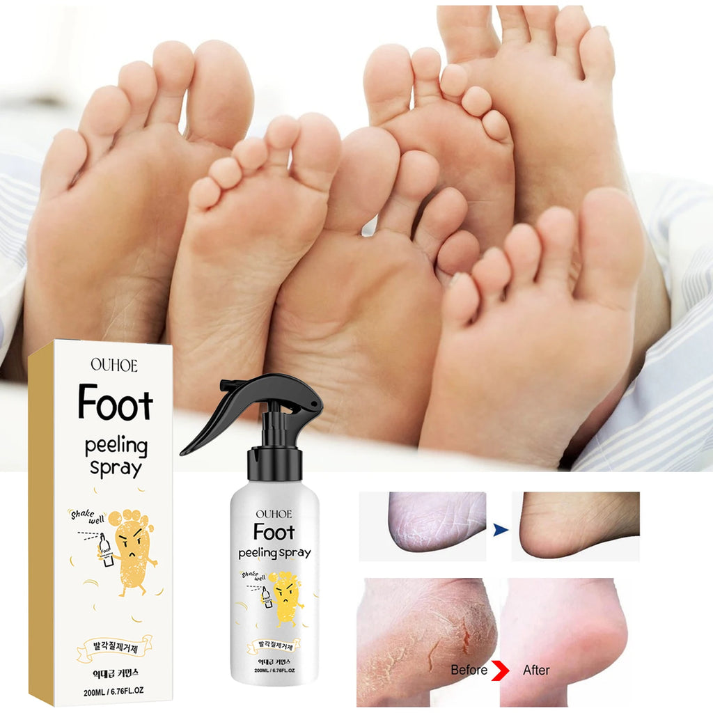 OUHOE Foot Exfoliating Spray 200ml – Callus Softener, Dry Cracked Heel Repair, 72H Moisture Lock & Odor Control Foot Care