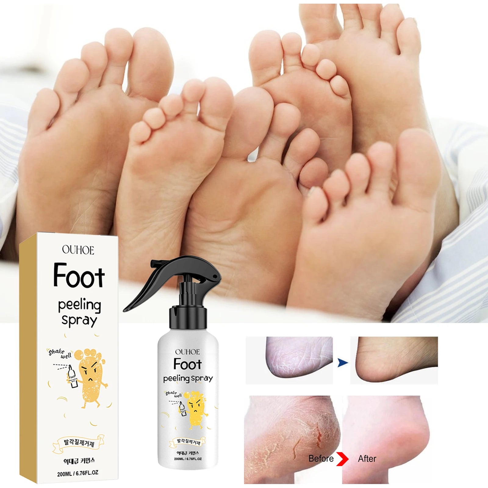 OUHOE Foot Exfoliating Spray 200ml – Callus Softener, Dry Cracked Heel Repair, 72H Moisture Lock & Odor Control Foot Care
