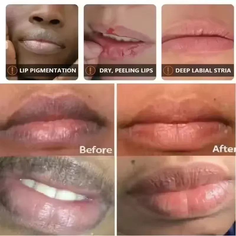 Brightening Lip Mask & Balm – Deep Moisturizing Overnight Lip Care
