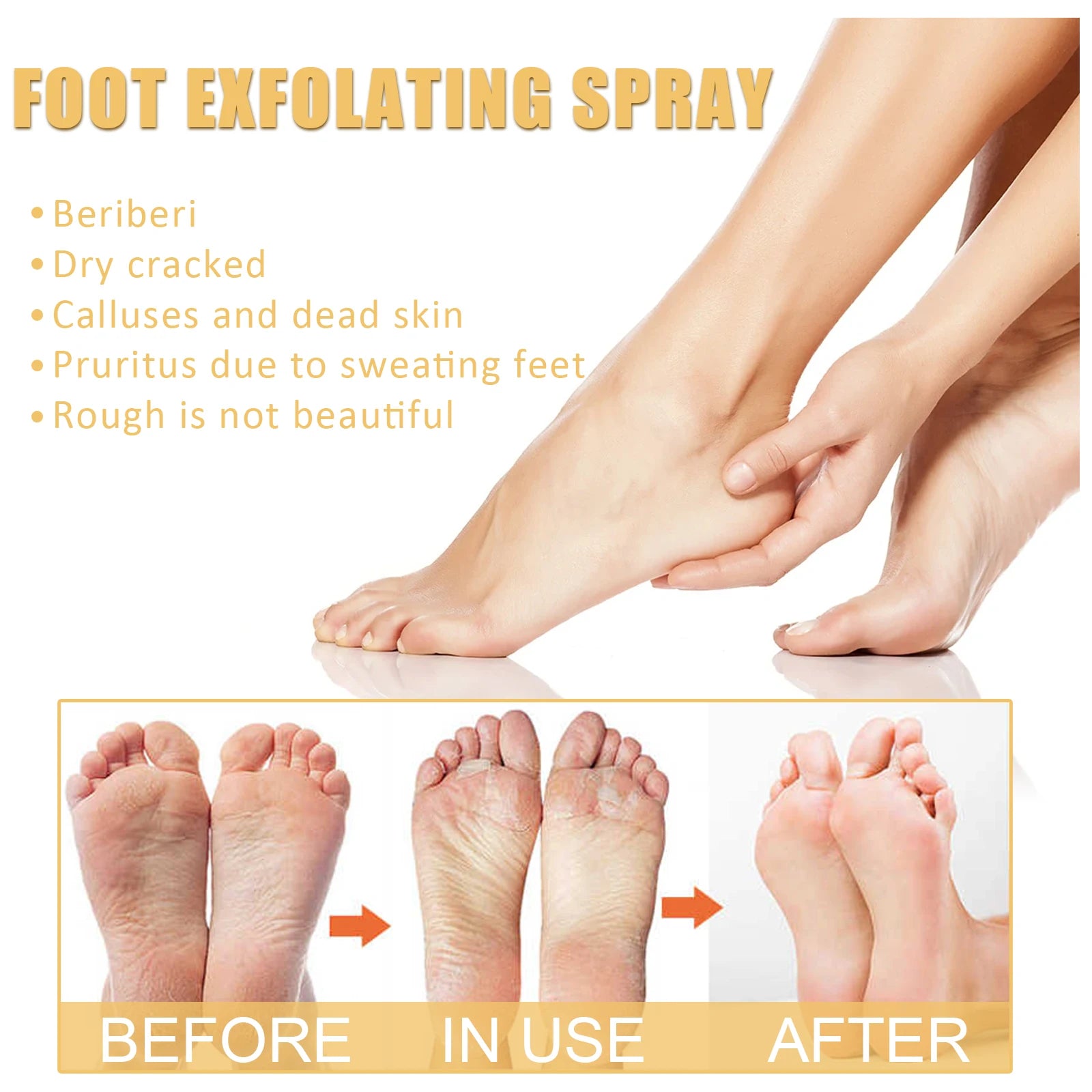 OUHOE Foot Exfoliating Spray 200ml – Callus Softener, Dry Cracked Heel Repair, 72H Moisture Lock & Odor Control Foot Care