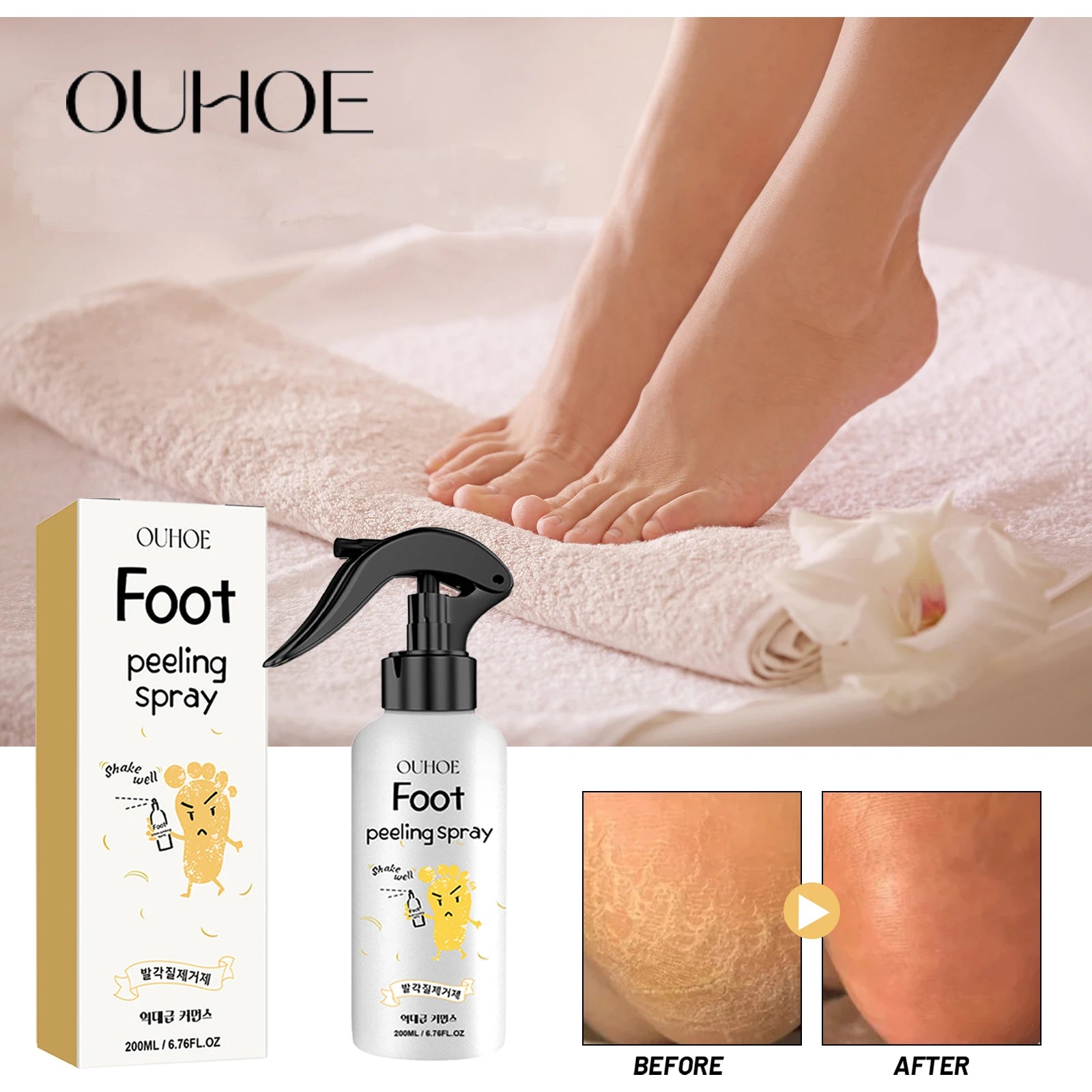 OUHOE Foot Exfoliating Spray 200ml – Callus Softener, Dry Cracked Heel Repair, 72H Moisture Lock & Odor Control Foot Care