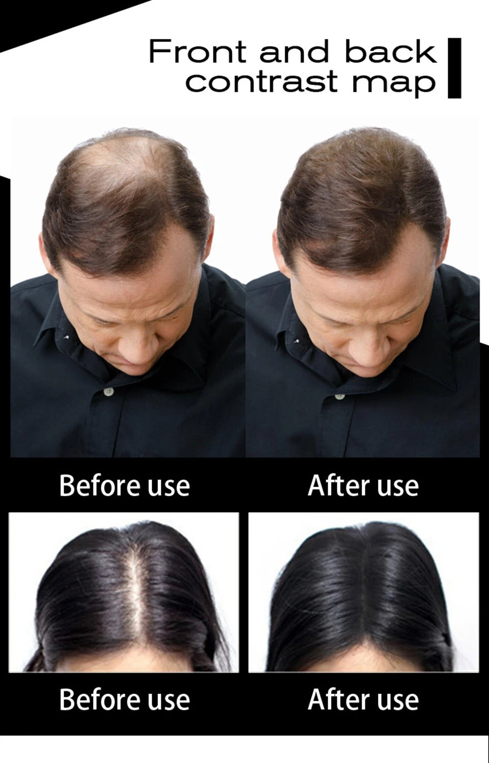 SEVICH 25g Hair Fibers Refill Bag Bald Extension Hair Growth Powder Salon Professional Hair Treatment Unisex Hair Loss Products