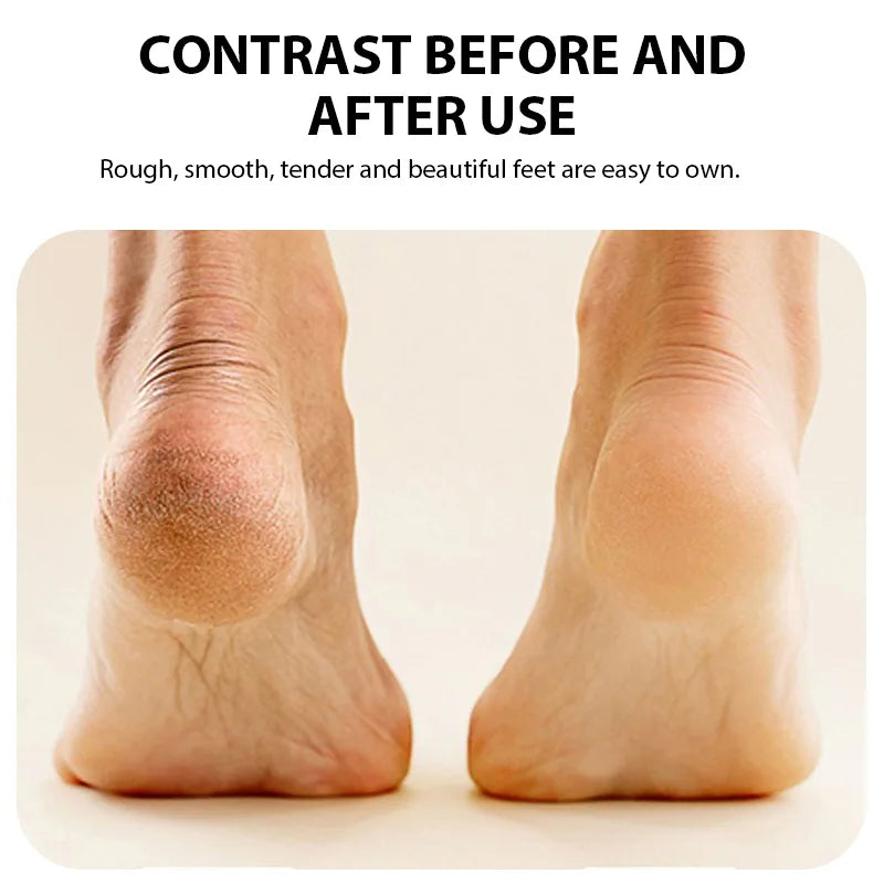 Rechargeable Electric Foot Callus Remover | 3 Grinding Heads | INAVI Well